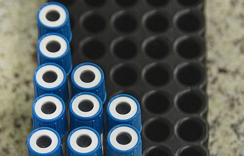 Blood-derived PRP preparation for a microneedling treatment at CFH