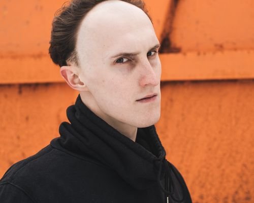 Receding hairline concern