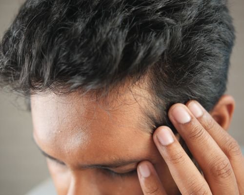 Hair thinning concern