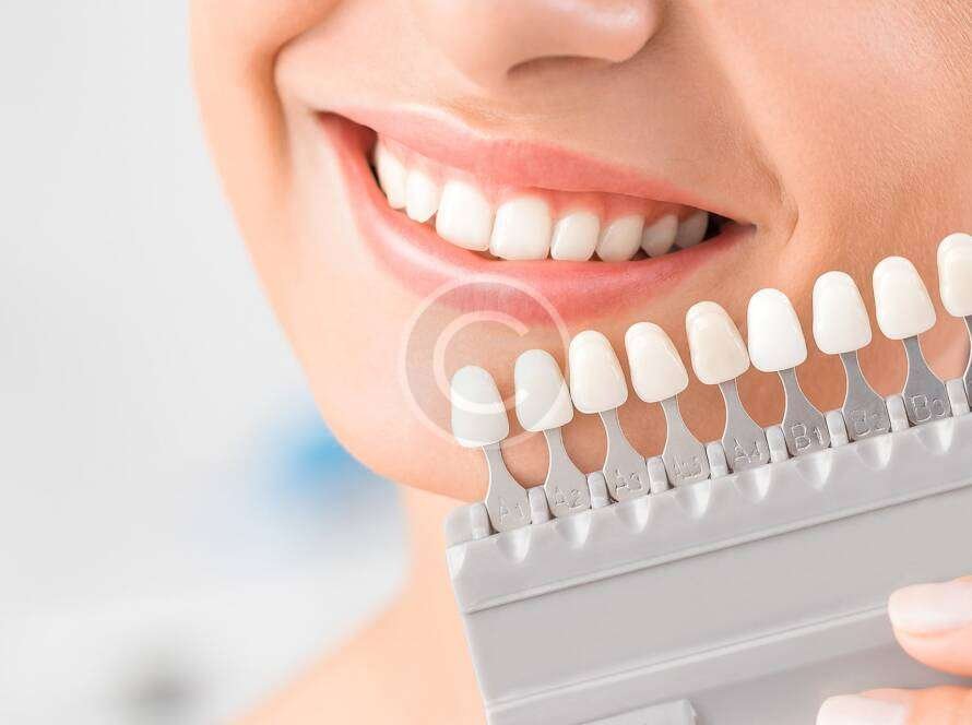 cheapest hair transplant in chennai