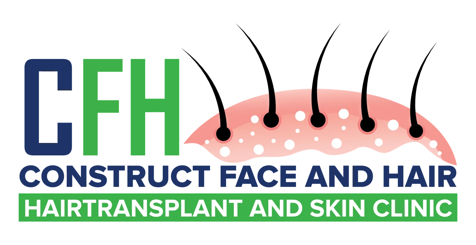 cfhhairtransplant-Best Hair Transplant Chennai