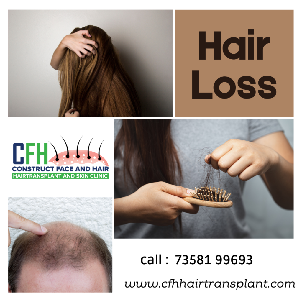 The Emotional Impact of Hair Loss and How Transplants Can Help