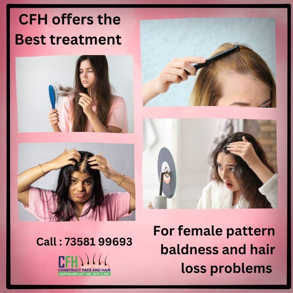 Hair Transplants for Women: Addressing Female Hair Loss with Precision