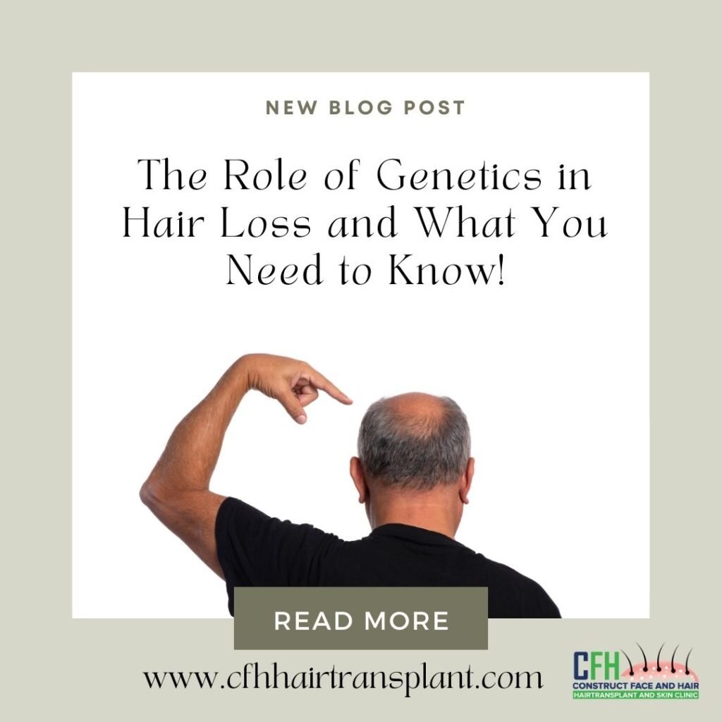 The Role of Genetics in Hair Loss: What You Need to Know