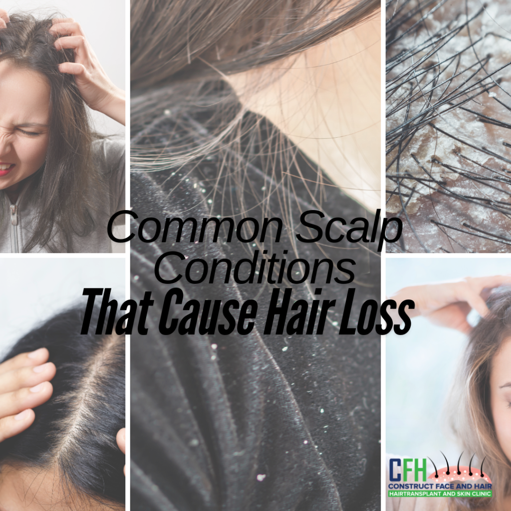 Common Scalp Conditions That Cause Hair Loss