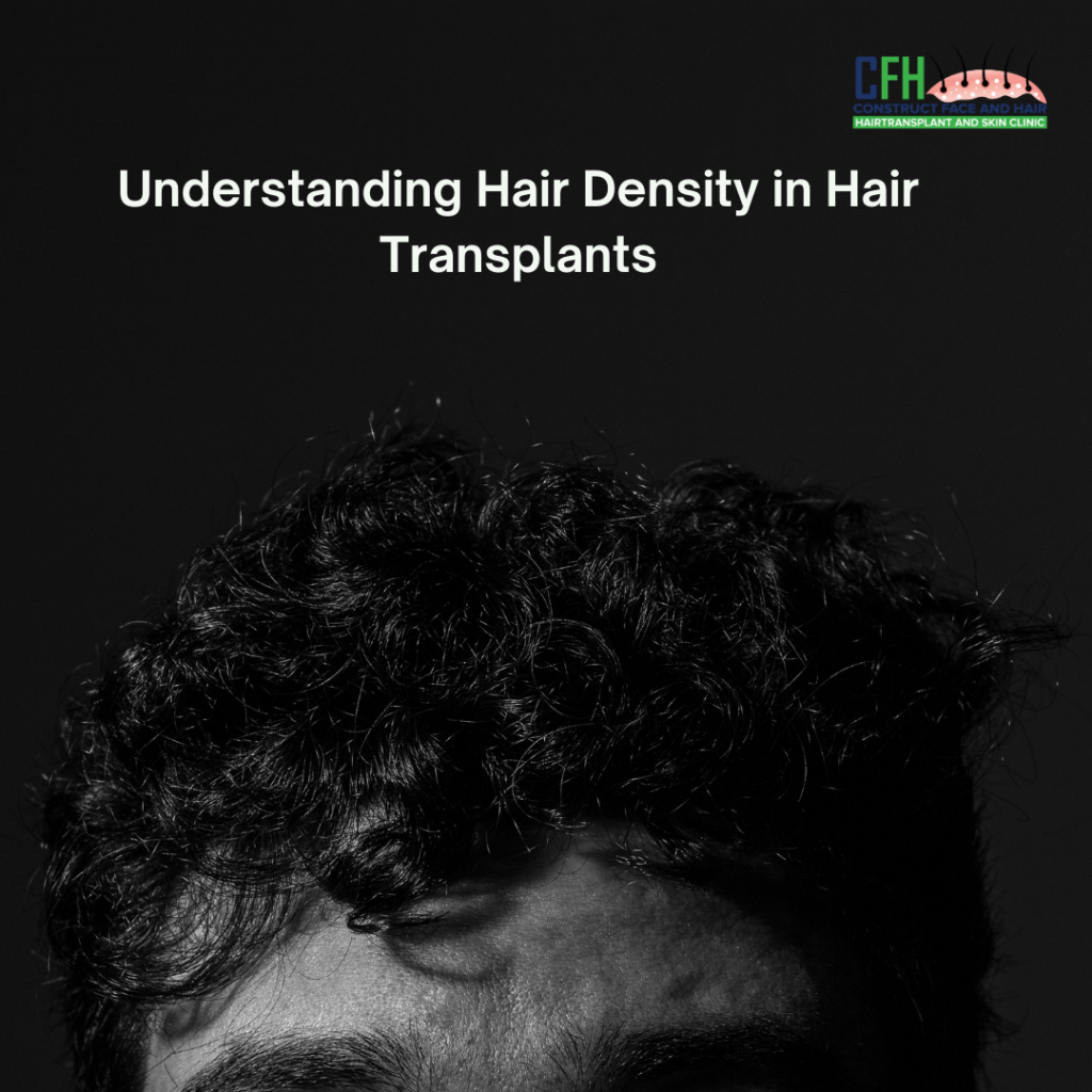 Understanding Hair Density in Hair Transplants