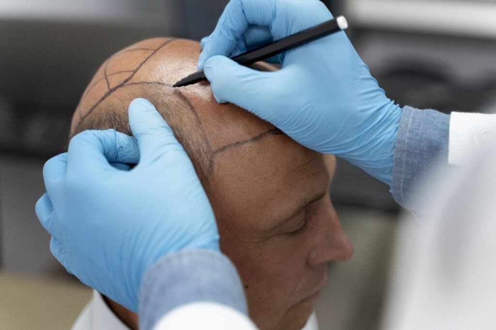 Chennai Hair Transplant and Skin Care: Affordable and Effective Solutions