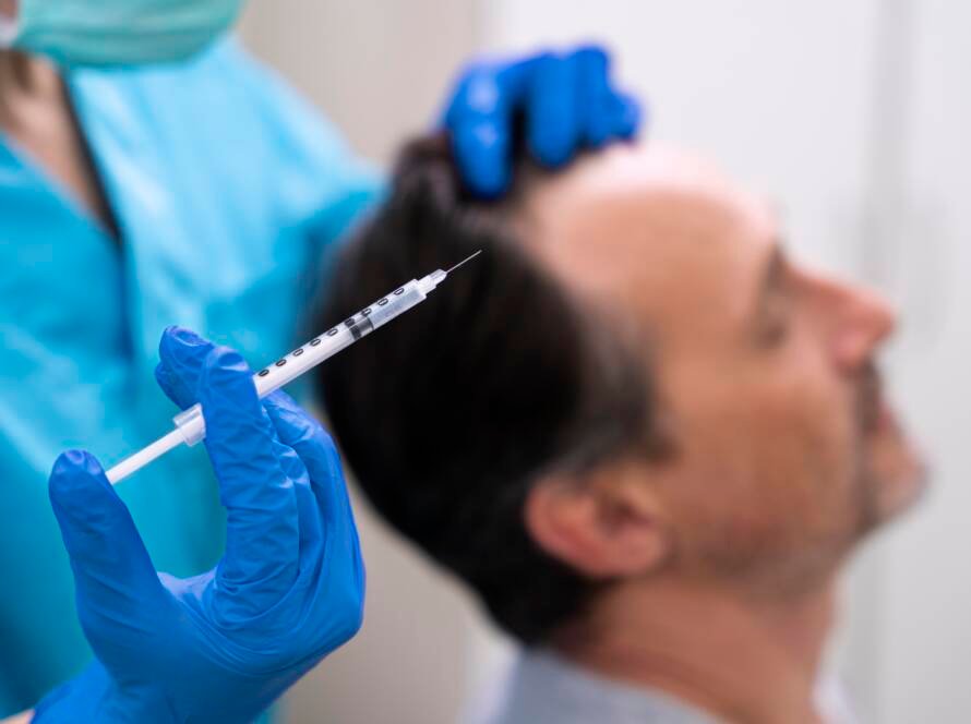 PRP vs GFC Hair Treatment in Chennai at CFH Skin and Hair Clinic for Hair Regrowth