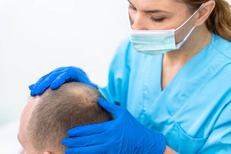 What Is Hair Transplant? A Complete Beginner’s Guide