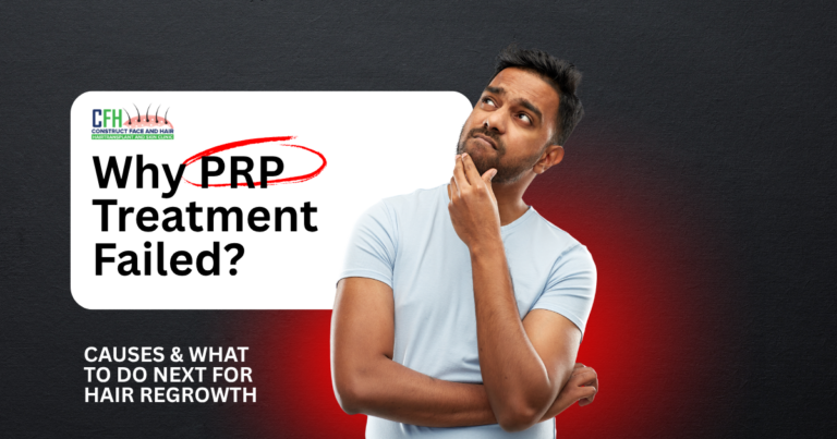 Why Your Previous PRP Treatment Didn’t Work And What to Do Next?