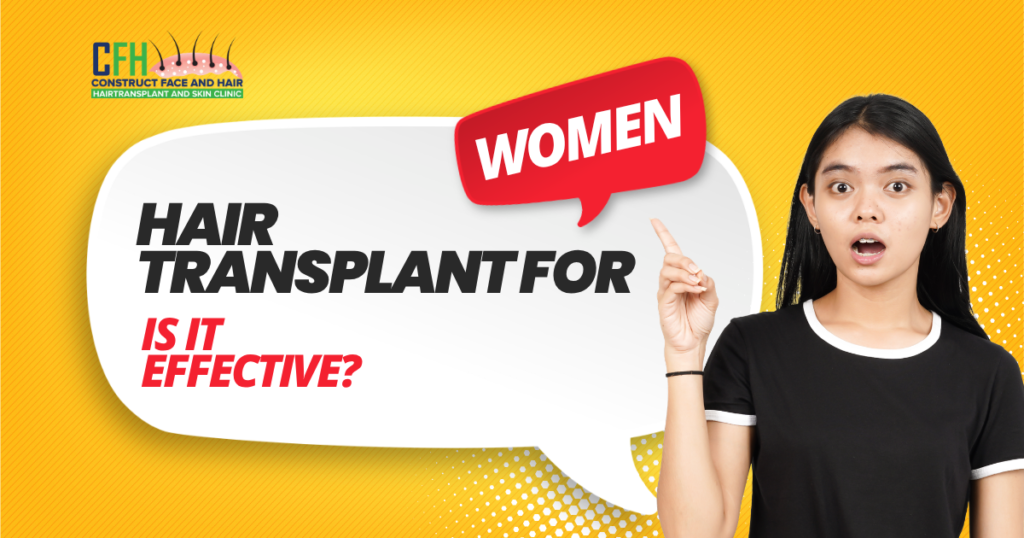 Hair Transplant for Women: Is It Effective?